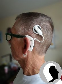 CI Kopf 2018 Erwachsen